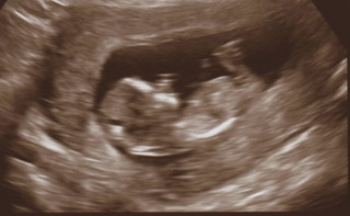 baby Ó